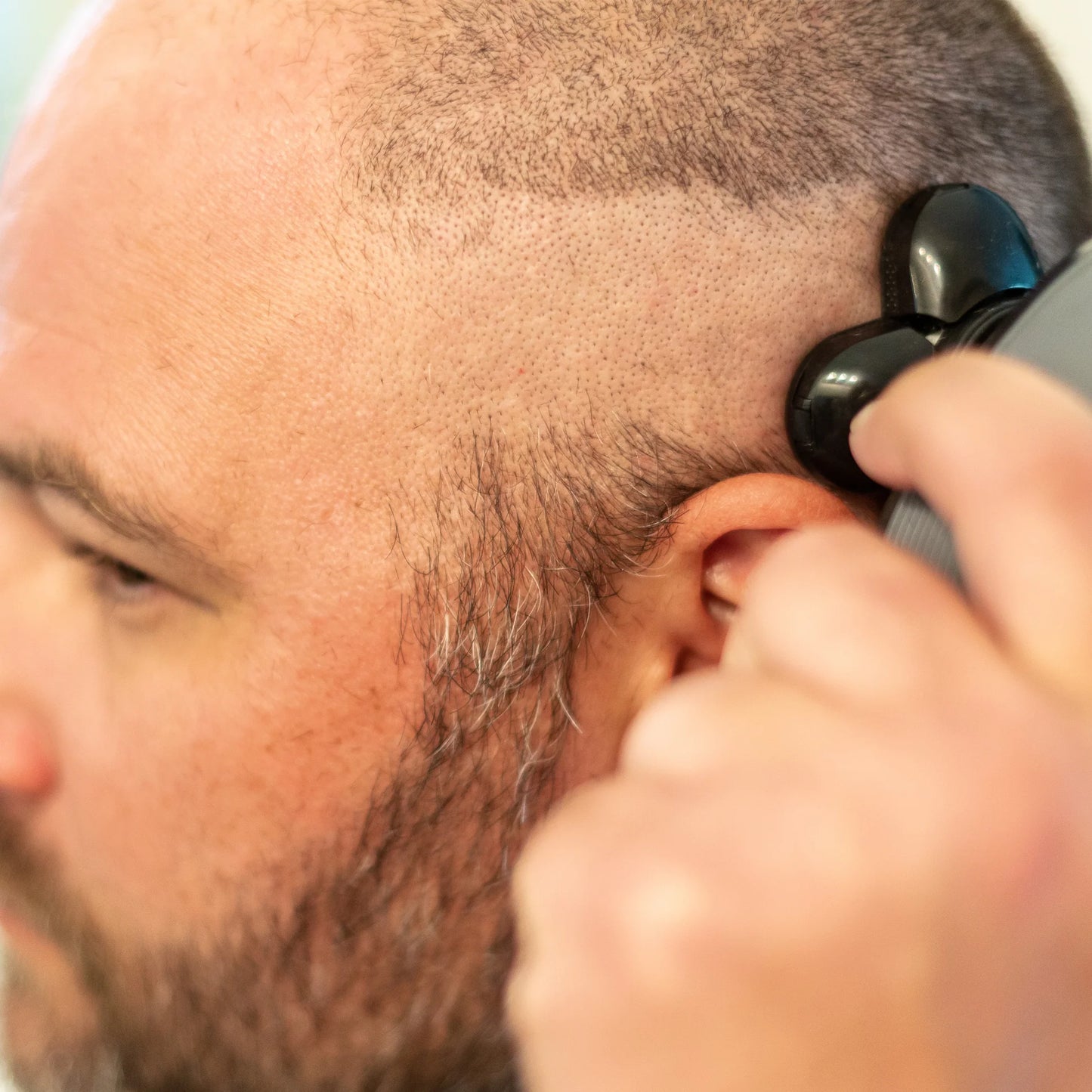 FullTrim™ by SharpCo: All-in-One Body Groomer